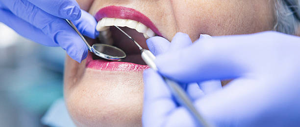 Best Same-Day Emergency Dentist in Horseshoe Bay, TX
